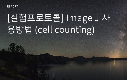 [실험프로토콜] Image J 사용방법 (cell counting)